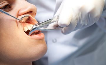 Complications during tooth extraction surgery
