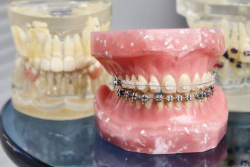 Myofunktionelle Therapie in der Kieferorthopädie. Funktionelle orofaziale Störungen und deren Einfluss auf die Entwicklung