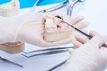 Die klinische Anwendung des Er,Cr:YSGG-Lasers in der Endodontie