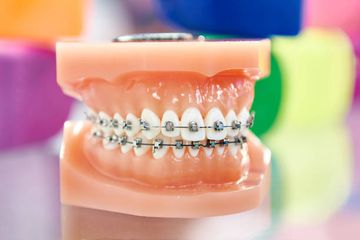 Morphofunktionelle Wiederherstellung des Kiefergelenks nach Kondilektomie, behandelt mit funktioneller Kieferorthopädie.