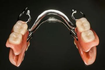 Elementi occlusali delle protesi scheletrate