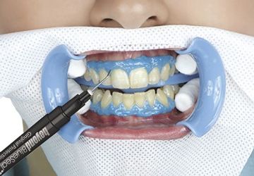 Hardware-Methode des Bleichens: Hauptphasen