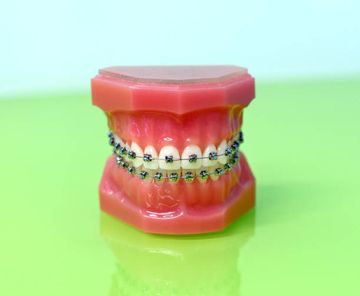 The Use of Functional Appliances in Contemporary Orthodontic Practice