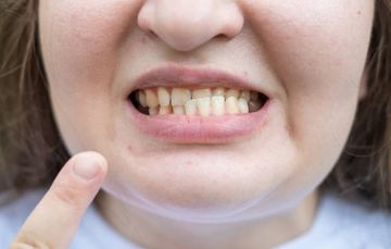 Analysis of Factors Leading to Occlusal Disorders in Patients with Intact Dental Arches and Orthognathic Bite Type