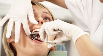 Complications during tooth extraction. Dislocation, fracture, aspiration