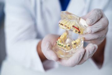 Управління дітьми з поганим прогнозом перших постійних молярів: міждисциплінарний підхід є ключовим