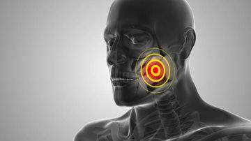 Fonseca anamnestic index for screening Temporomandibular Disorders - reliability to discriminate muscular from intra-articular disorders.