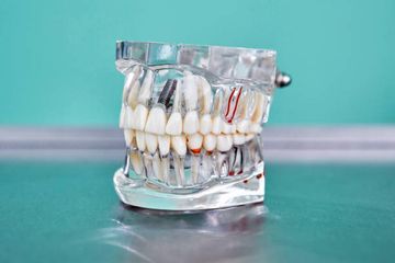 Influence of Demographic Factors on the Prevalence of a Second Root Canal in Mandibular Anterior Teeth – A Systematic Review and Meta-Analysis of Cross-Sectional Studies Using Cone Beam Computed Tomography