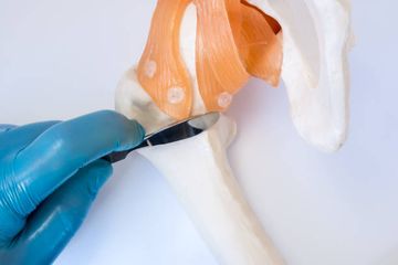 Implantes de Disco Bioingenierizado para la Articulación Temporomandibular: Protocolo de Estudio para un Ensayo Piloto Preclínico Aleatorizado en Dos Fases en 18 Ovejas Merino Negras (TEMPOJIMS)