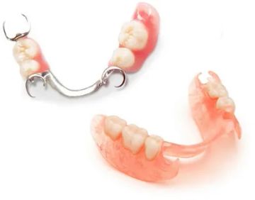 Caratteristiche comparative delle protesi parziali rimovibili