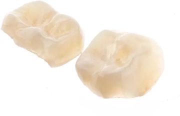 Protocol for Indirect Restoration Intraoral Scanning Under Dental Dam Isolation: A Dental Technique