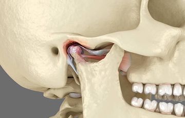 Diagnostics of Temporomandibular Joint (TMJ) Disorders: A Comprehensive Guide