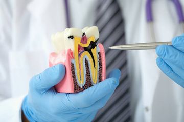 Management von refraktären endodontischen Erkrankungen mit radialer apikaler Reinigung