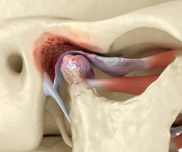 Patient experience and satisfaction with different temporomandibular joint treatments: A retrospective study