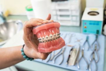 The importance of treatment planning and patient compliance in the clear aligner orthodontic technique