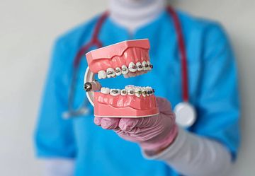 Kieferorthopädie und orthognatische Chirurgie im Oberkiefer
