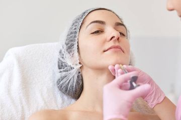 Rimodellamento del viso con prodotti a base di PMMA con tecnica di bioarmatura