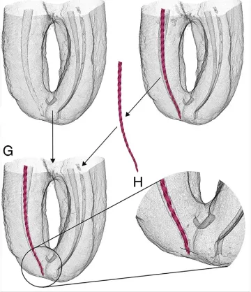 Clinical Accuracy and Precision of 3 Multifrequency Electronic Apex Locators Assessed through Micro–Computed Tomographic Imaging