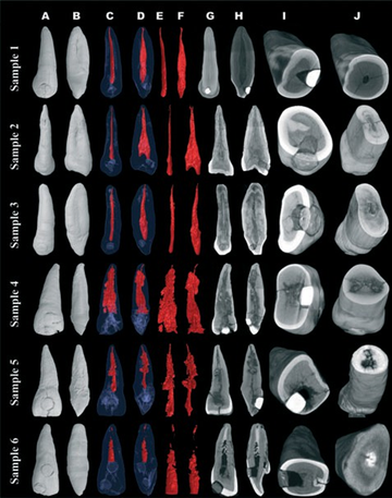 Maya Tooth Modification 3D Micro-CT Analysis of Ancient Maya Dental Inlays