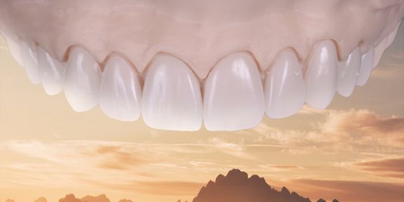 Free webinar by Carlo Arcara: Errors in Prosthetic Treatment | OHI-S