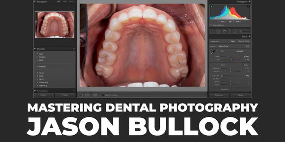 Mastering Dental Photography: Essential Editing Techniques