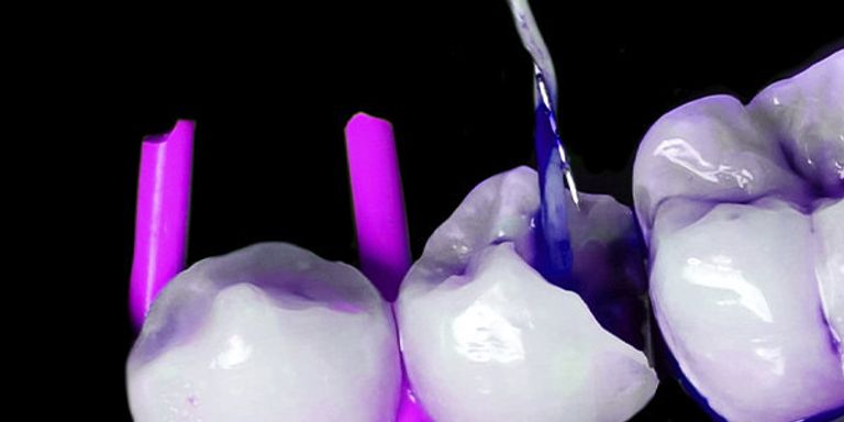 EndoEvolution: Endodontic Perspective on Dental Trauma