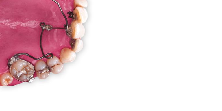 Biomechanics fundamentals of orthodontic therapy
