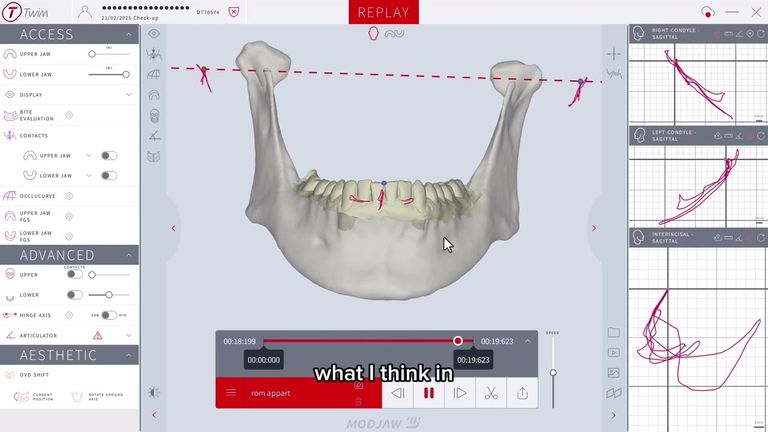 Webinar by Javier Vasquez: Biofunctional Dynamic Considerations | OHI-S