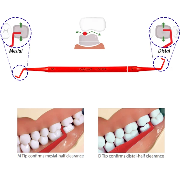 ContacEZ PrepSure Classic Colors Crown Prep Guide Red- 1.5mm 3/Pk. Double-Sided