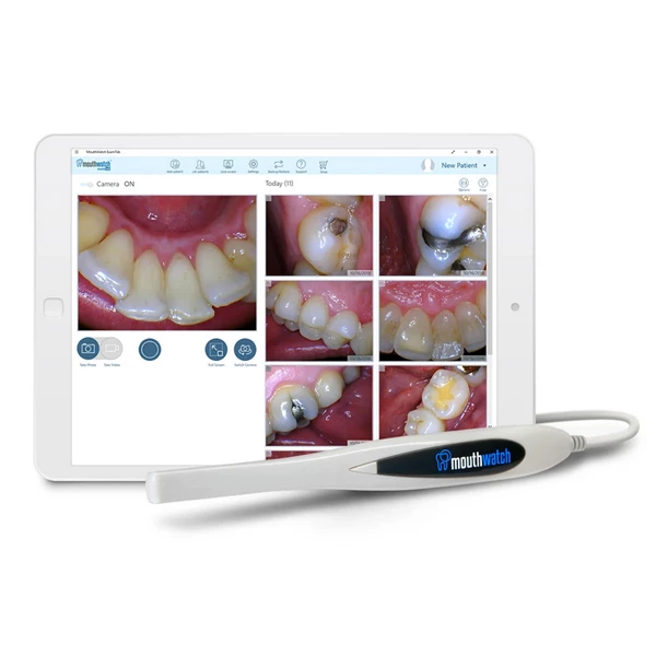 Cámara intraoral MouthWatch con captura de un solo botón. Ligera.