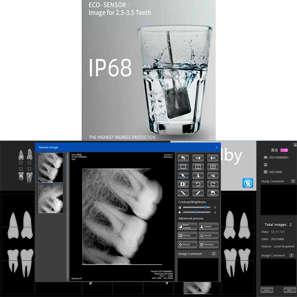 AppleDental Eco-sensor Size 2 Digital X-Ray Sensor