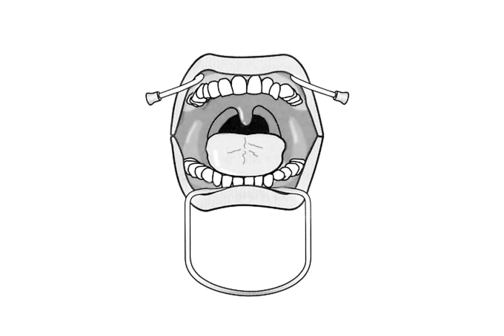 Oringer Lippenhalter - Groß 60 x 115 mm