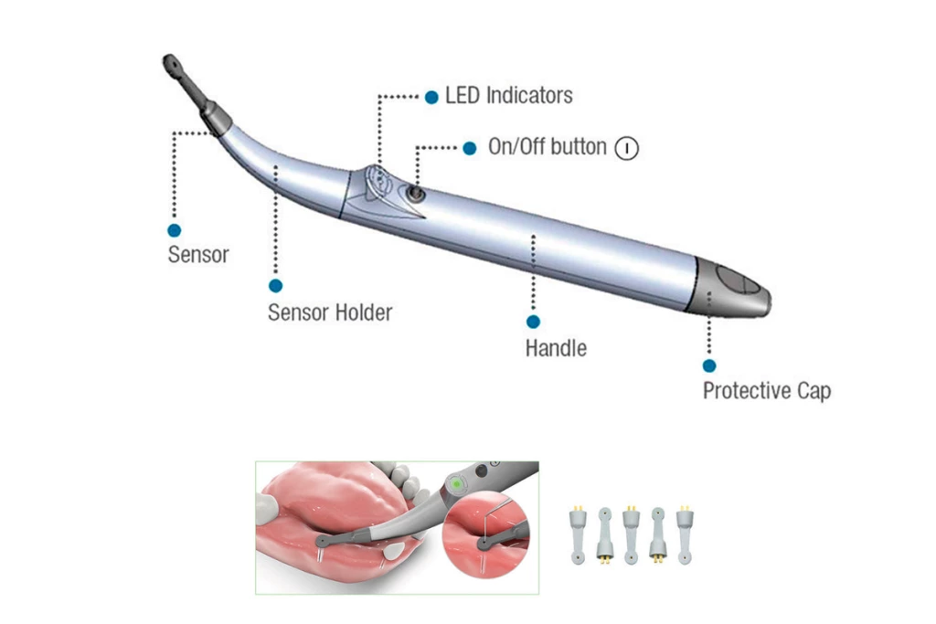 Localizador de Implantes - Unidad Completa Localizador