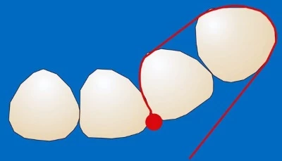 Transparente Stopstreifen 1.441 (12 Stück)