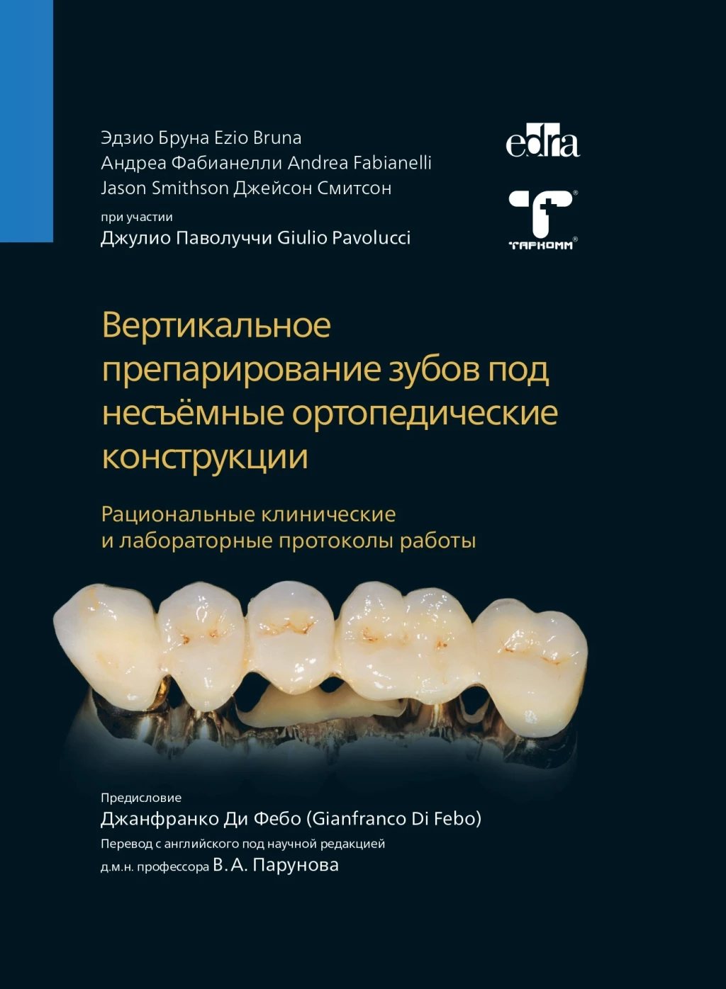 Preparación vertical de dientes para estructuras ortopédicas fijas - Edzio Bruna