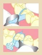 Sistema de Matrices Squeeze Cure-Thru - Matrices Squeeze Cure-Thru - Molar