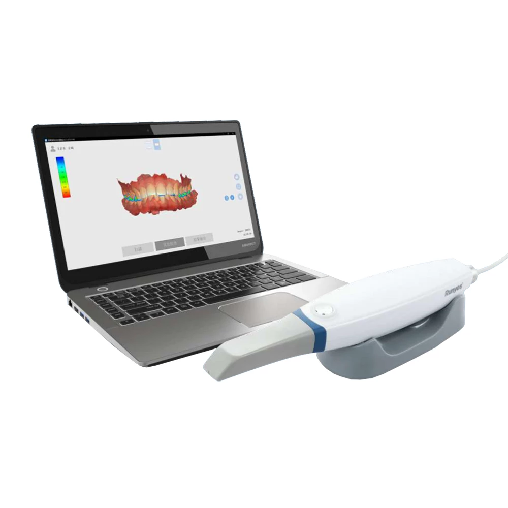 QuickScan IOS de Runyes, escáner intraoral 3D con laptop.