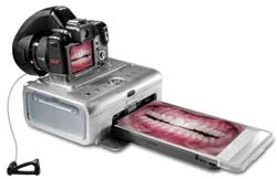 Kodak P712 Dental Digital Photography System - 7.1 Megapixel, innovative dental