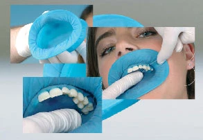 OptraDam Plus, dique de goma con forma anatómica, paquete surtido. El paquete contiene