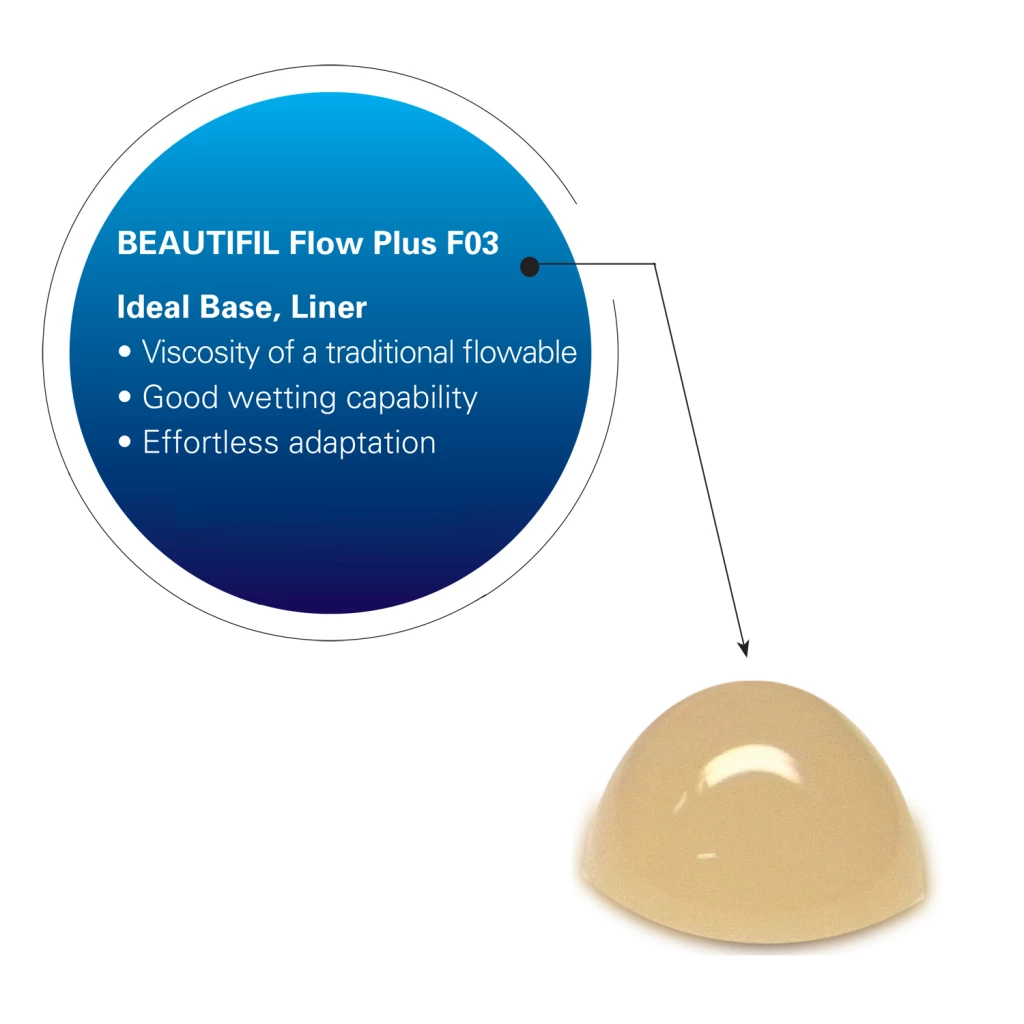 Beautifil Flow Plus F03 Low Flow - A3 Compules, 20 x 0.21 gram Compule Tips