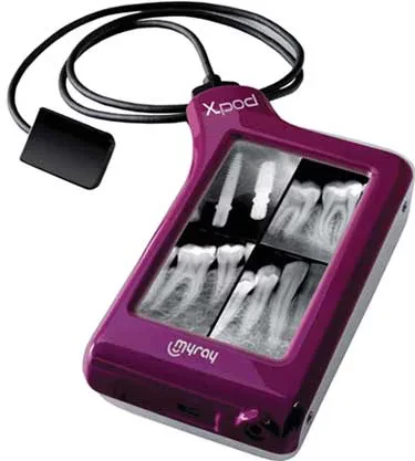 X-Pod de MyRay