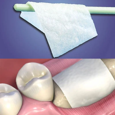 Membrana dental de colágeno regenerativo MatrixFlex 20mm x 30mm, 1/caja. Fuerte.