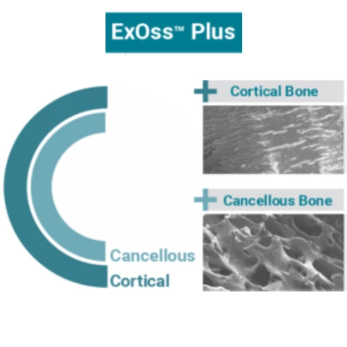 ExOss Plus 2.0cc Bone Particulate 0.850-1.50mm. Mineralized Cortical/Cancellous Bone